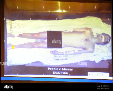 michael jackson autopsy photo|Michael Jackson Autopsy Photo Shown in Conrad Murray